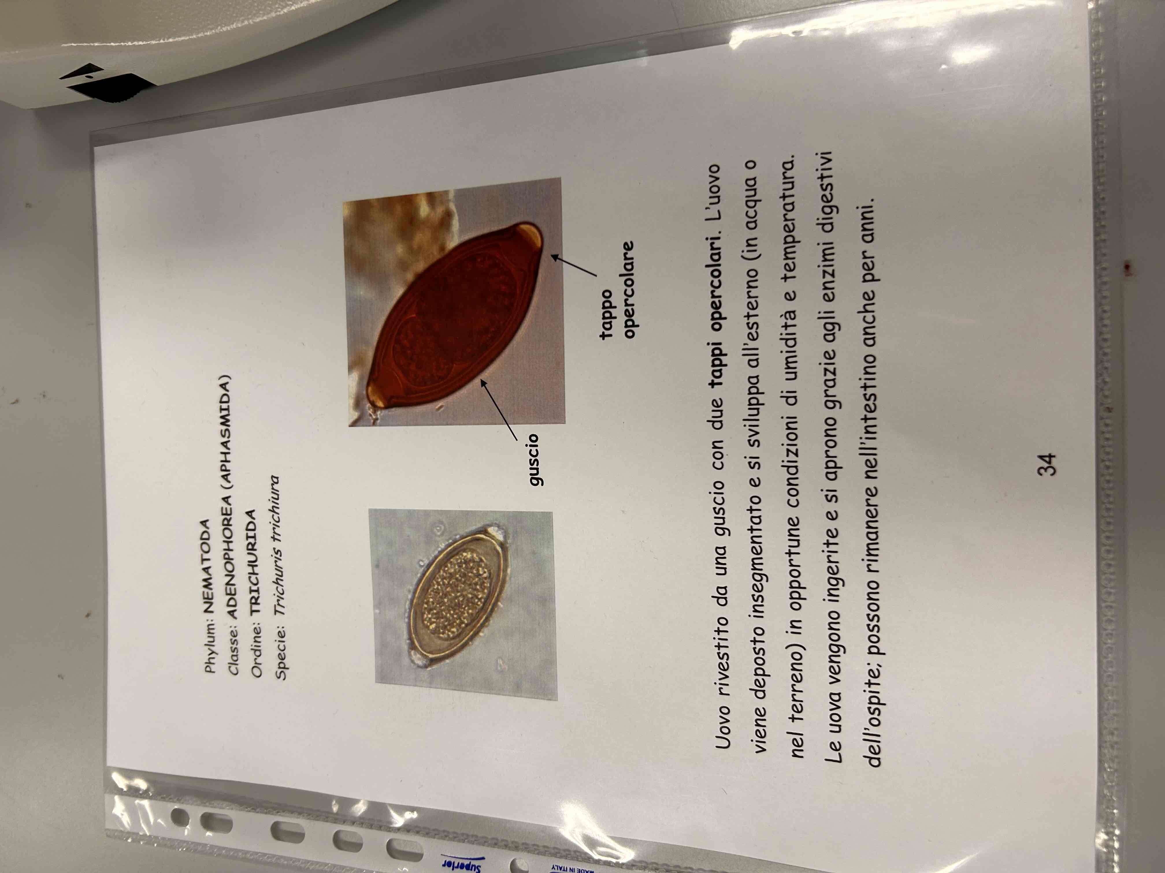 <p>Thrichuris trichiura (uovo)</p>