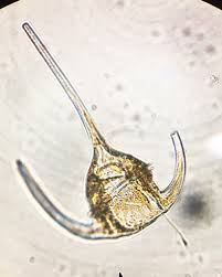 <p>Kingdom: Protista<br>
Phylum: Dinoflagellata </p>