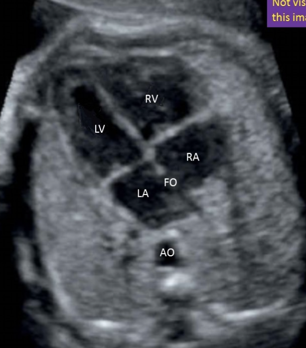 <p>b) top right </p>