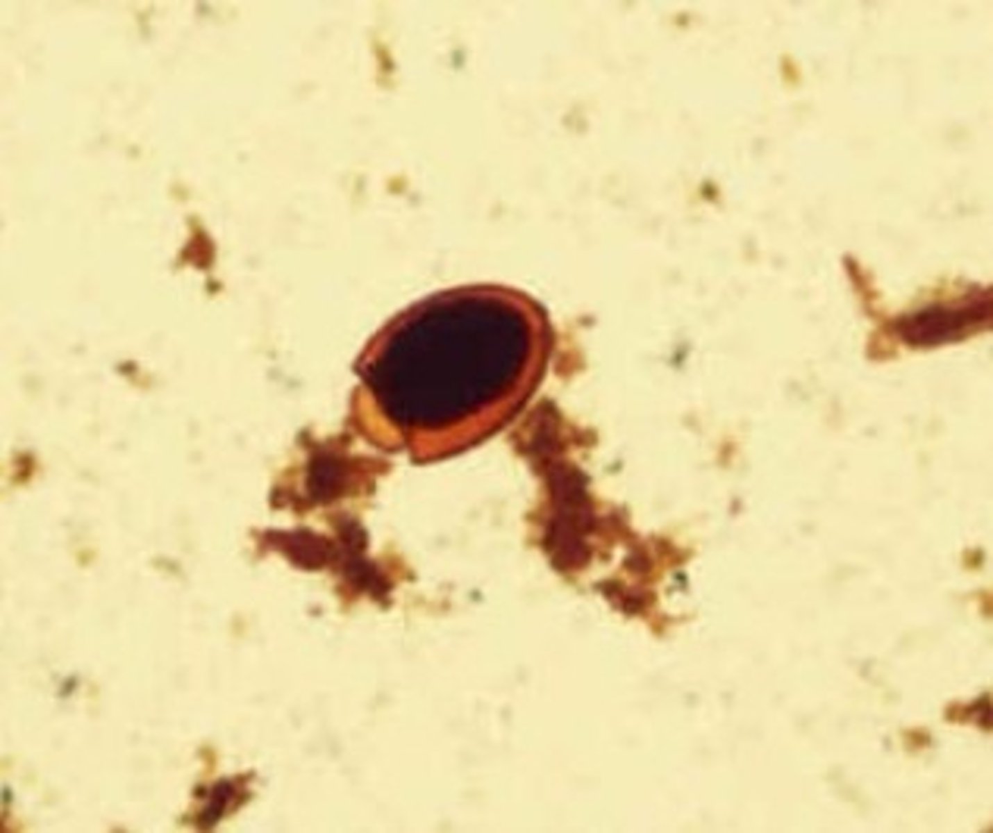 <p>Identify the parasite</p>