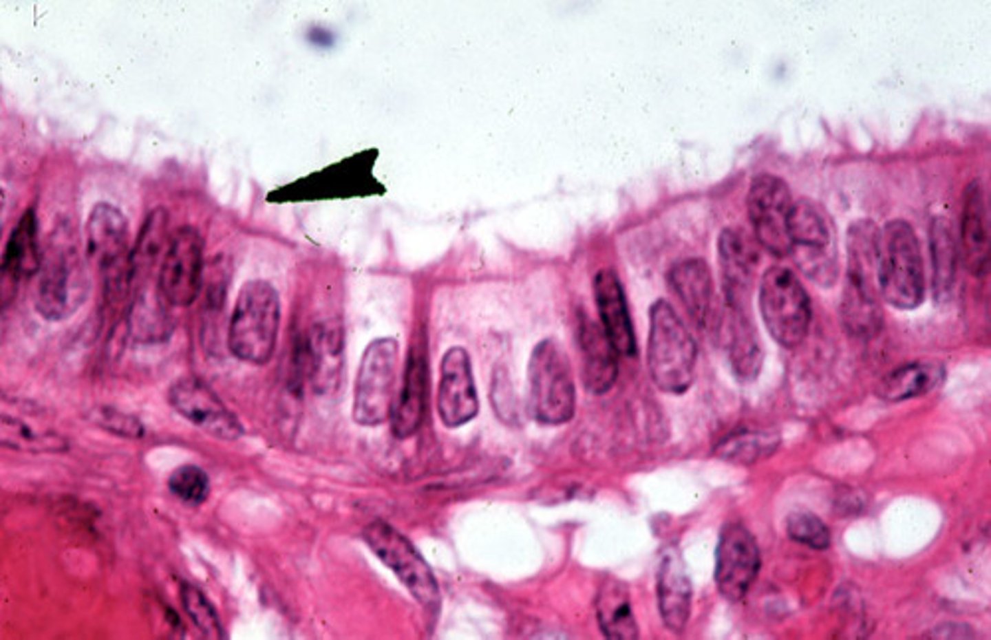 <p>single layer of tall column shaped cells</p><p>- absorption, secretion of mucus, enzymes, and other substances</p><p>- nonciliated type lines most of the digestive tract (stomach to anal canal), gallbladder and excretory ducts of some glands</p><p>- ciliated variety lines small bronchi, uterine tubes, and some regions of the uterus</p>