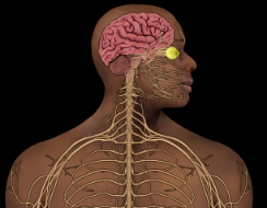 term image