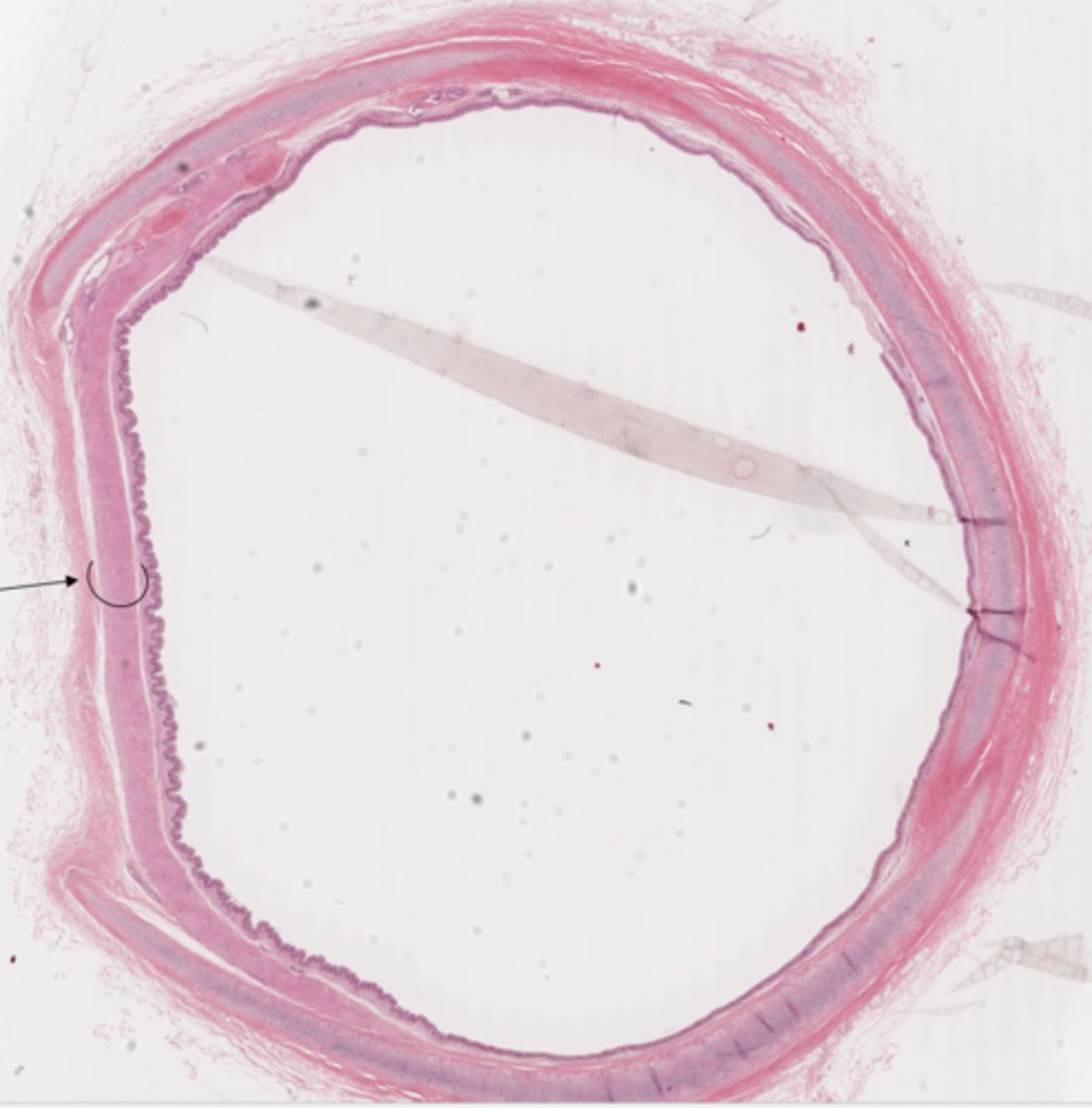 <p>Identify the muscle and organ</p>