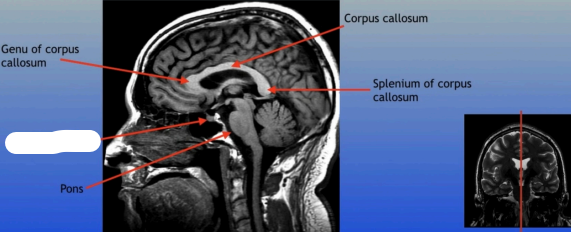 <p>A small pea-sized gland located at the base of the brain, often referred to as the "master gland" because it regulates many bodily functions through hormone secretion. </p>