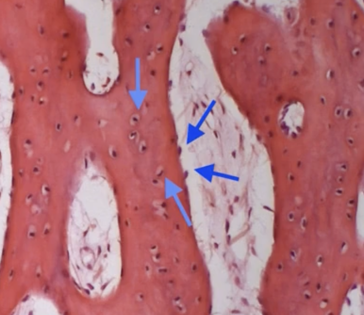 <p>What part of bone are the dark blue arrows pointing to?</p>