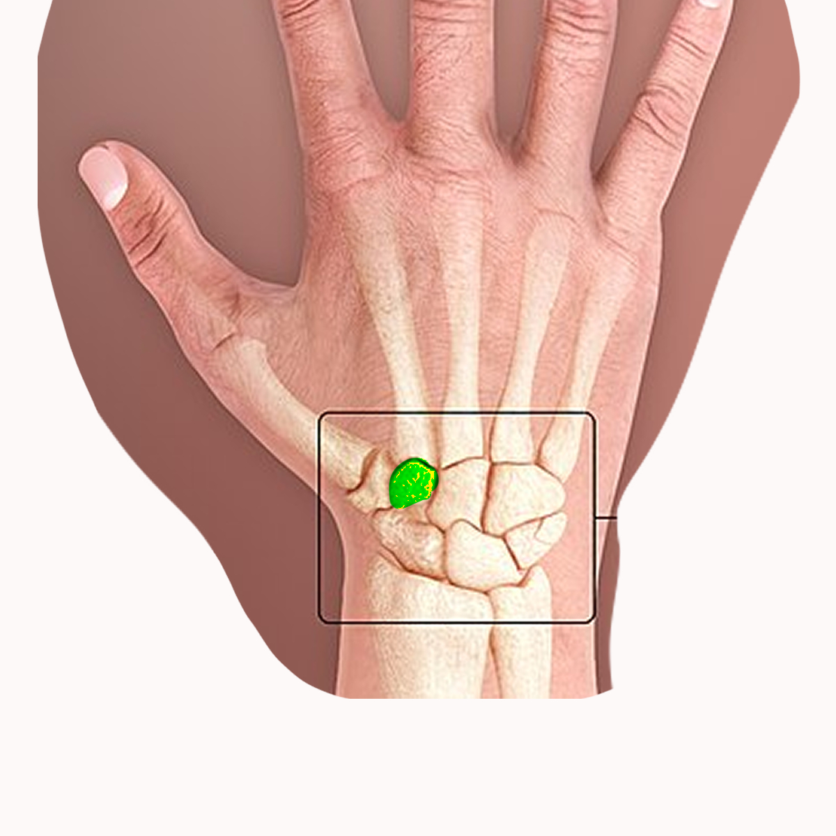 <p>Name the highlighted carpal</p>