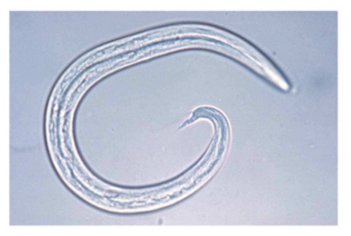 <p>This nematode of the respiratory system of the cat has a characteristic "s-shape" to the tail. This parasite is __</p>