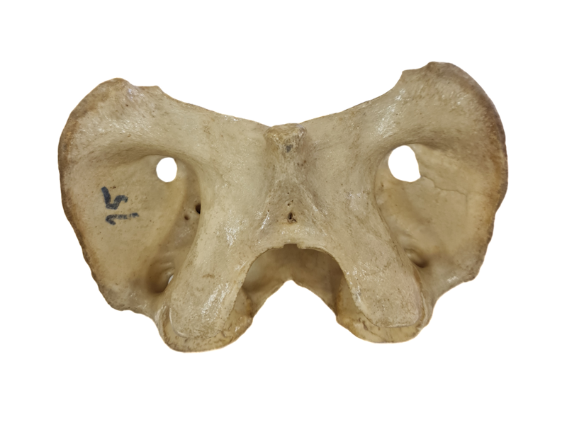 <p>Primeira vértebra cervical</p>