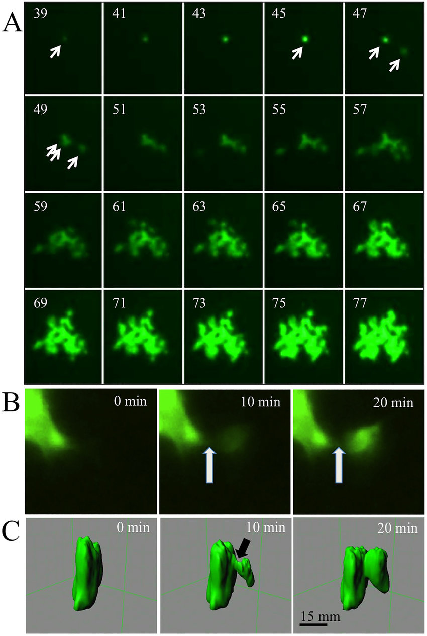 Time-lapse microscopy analysis of MV-infections center in HAE