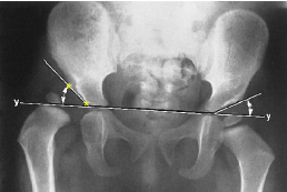 <p>Q what is the name of this measurement? and what is the average + range?</p>