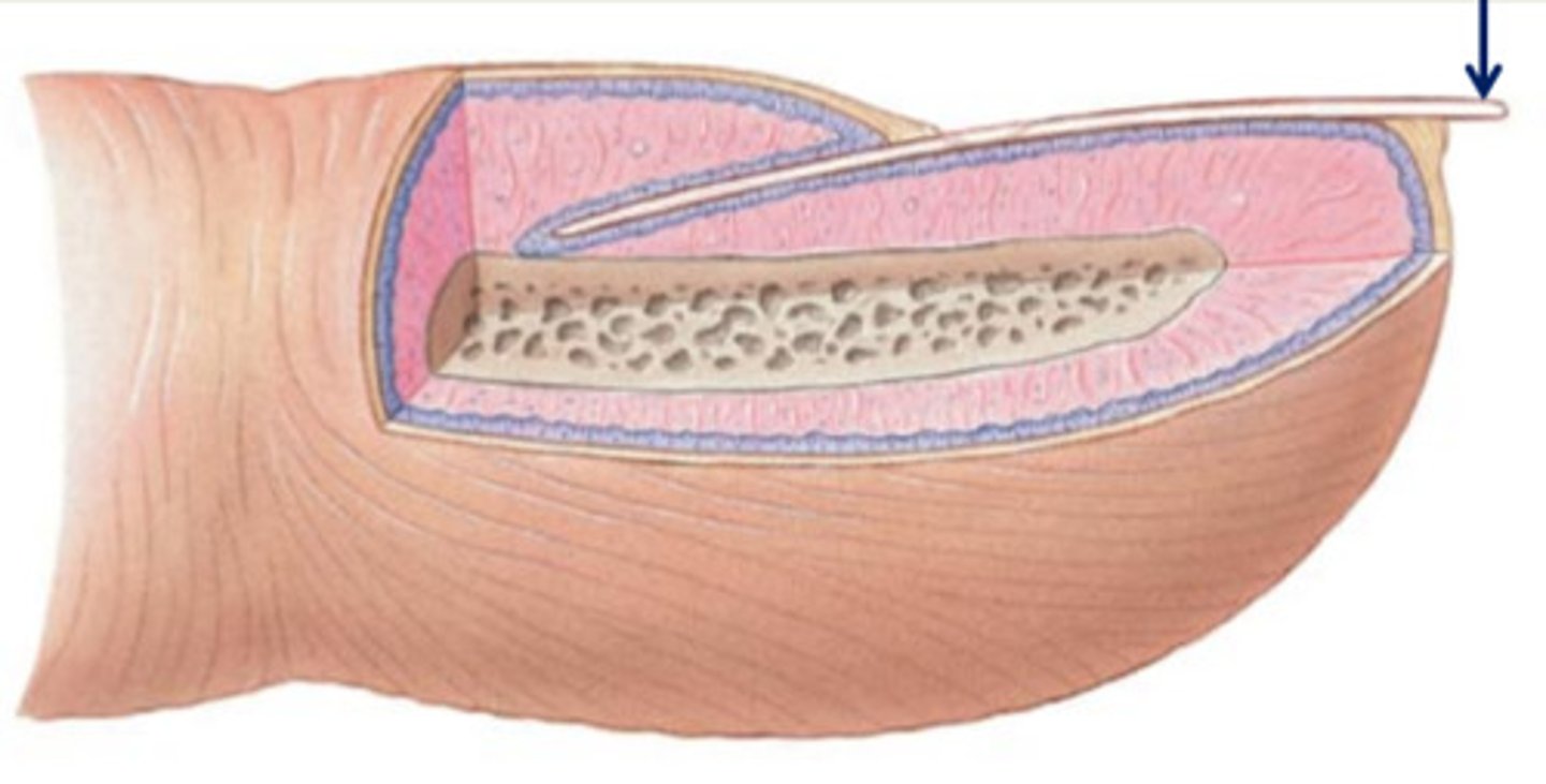 <p>extends past the finger or toe</p>
