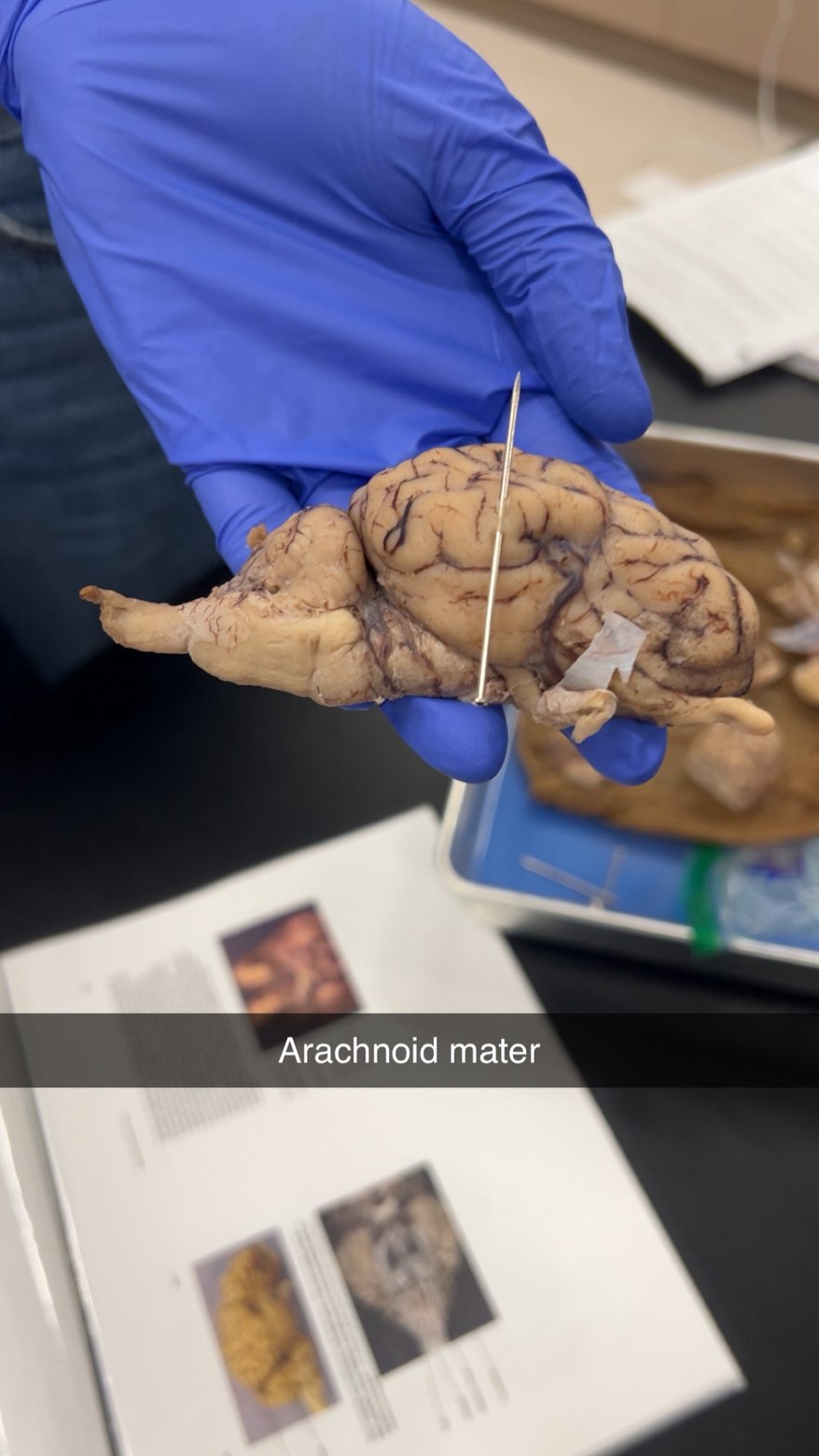 <p>arachnoid mater</p>