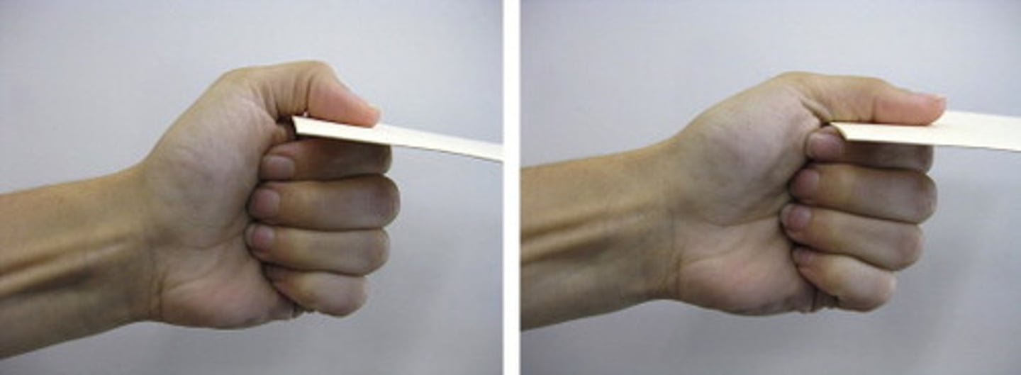<p>Assess weak AP and short head FPB indicates ulnar entrapment; + test is flexion at thumb IP d/t overeliance on FPL</p>