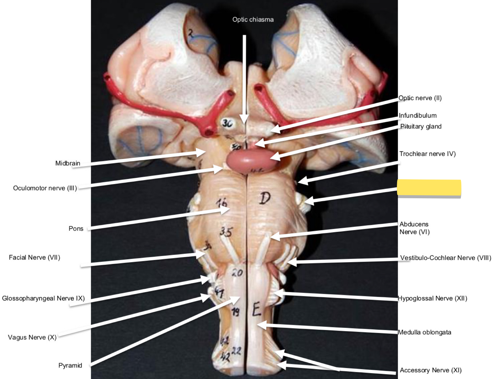 <p>Name this cranial nerve&nbsp;</p>
