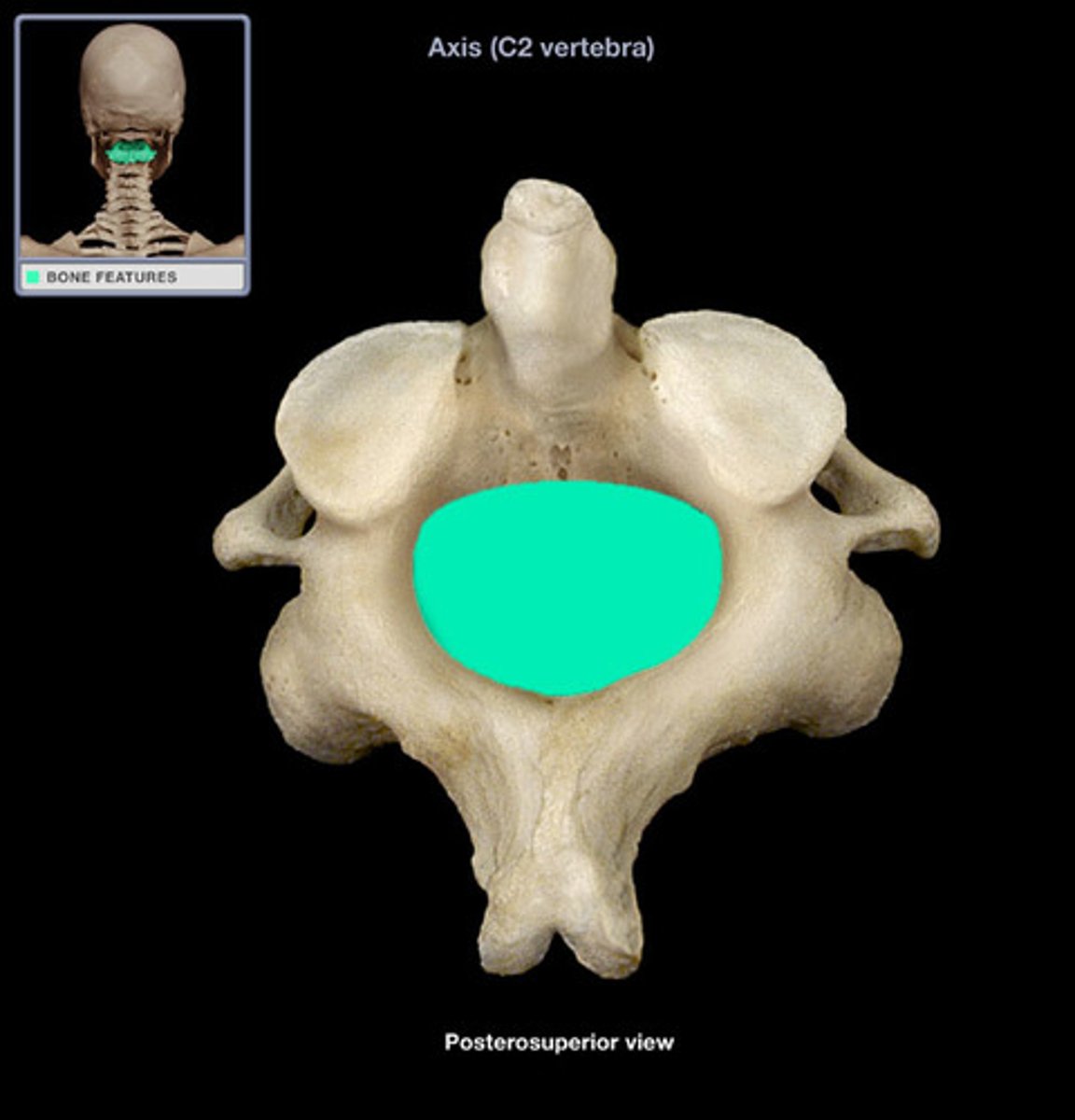 <p>(what vertebra and what structure is highlighted)</p>