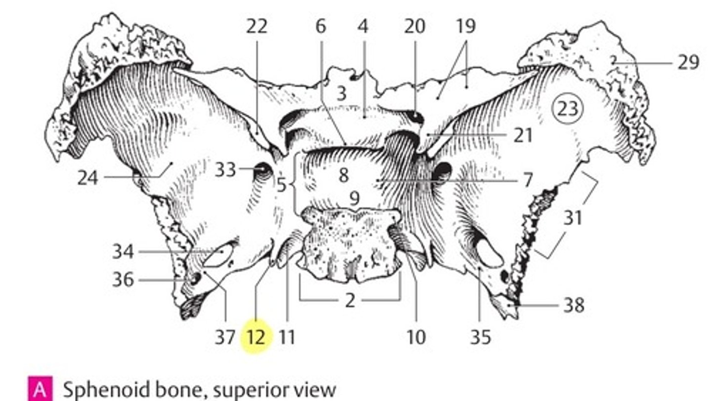 <p>wat is dit? (36)</p>