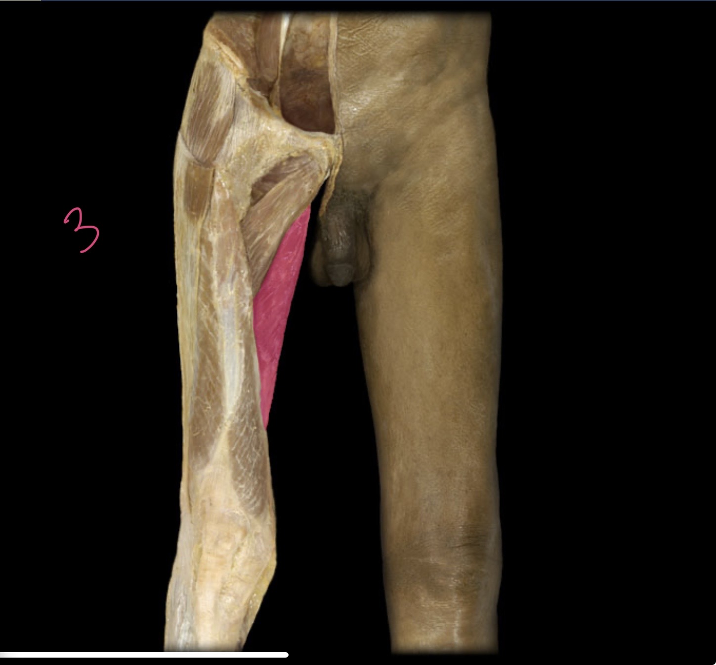 <p>Adductor magnus </p>
