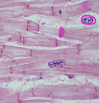 <p>Identify this muscle & it’s defining features?</p>