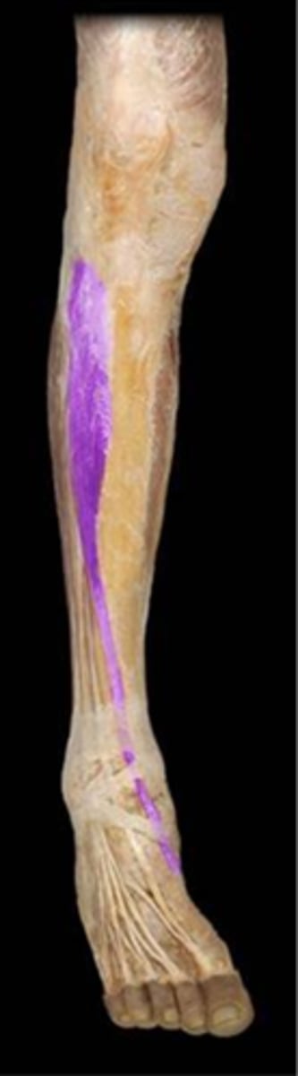 <p>What is the name of this muscle, highlighted in purple ?</p>