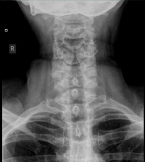 <p>What projection, position, and anatomy is this?</p>