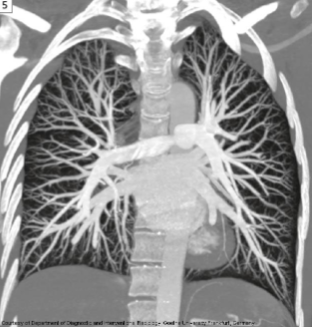 <ol><li><p>Which imaging modality is used for this image? </p></li><li><p>This modality can be used to look for what pathology?</p></li></ol><p></p>