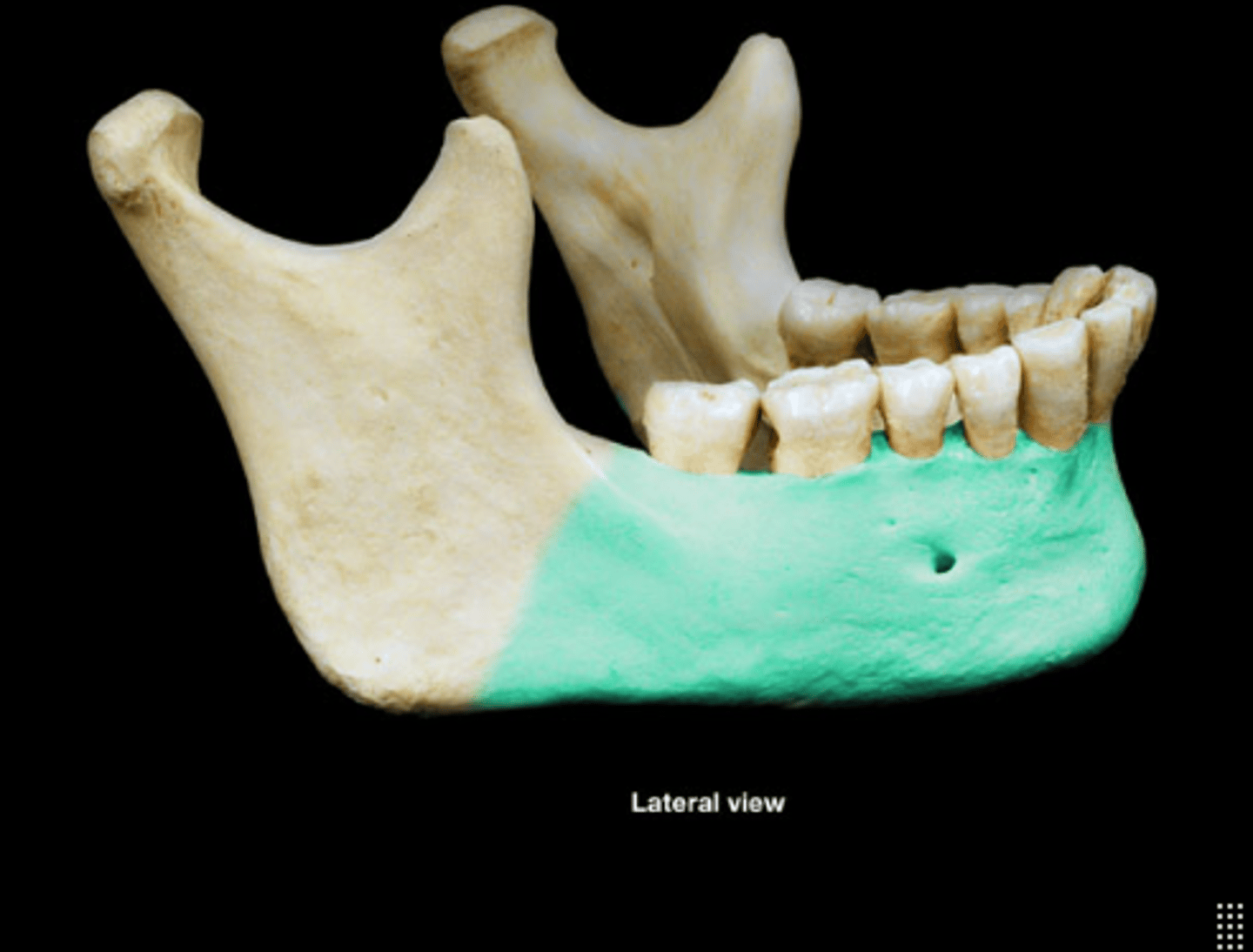 <p>Main horizontal portion of the lower jaw.</p>