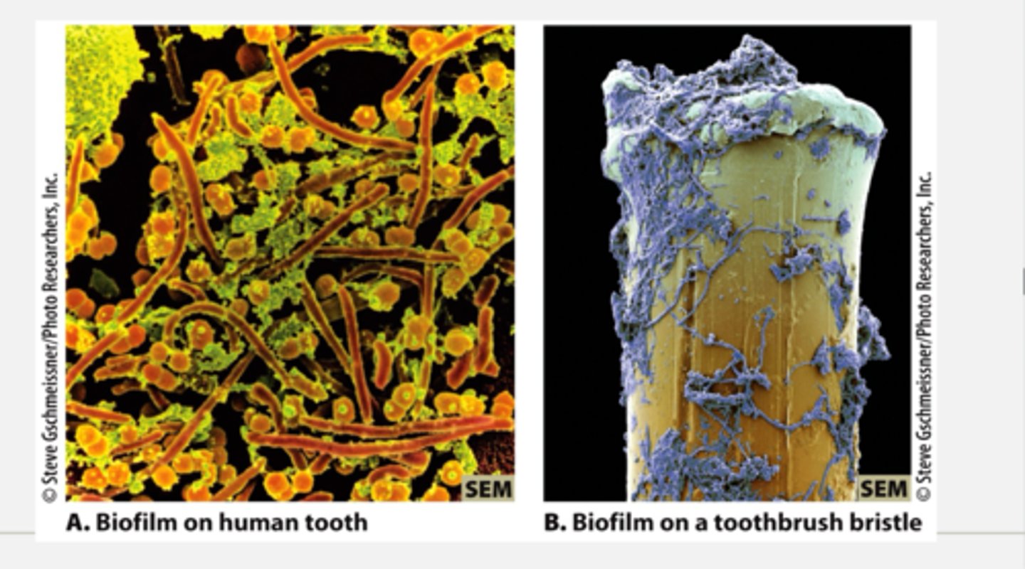 <p>- specialized, surface attached communities (ex. dental plaque and mold on bathroom surfaces)</p><p>- provide protection/enhanced survival</p><p>- often contain multiple microorganisms (like bacteria archea and eukaryotes all in one community)</p><p>- once the targeted critical mass of the community is reached, they will start to secrete the polysacharide that will form coating over the community to protect it and attachmnet will provide defenses against immune systems (like an animal host for example)</p><p>ex. of biofilms = decoloration on shower curtains</p>
