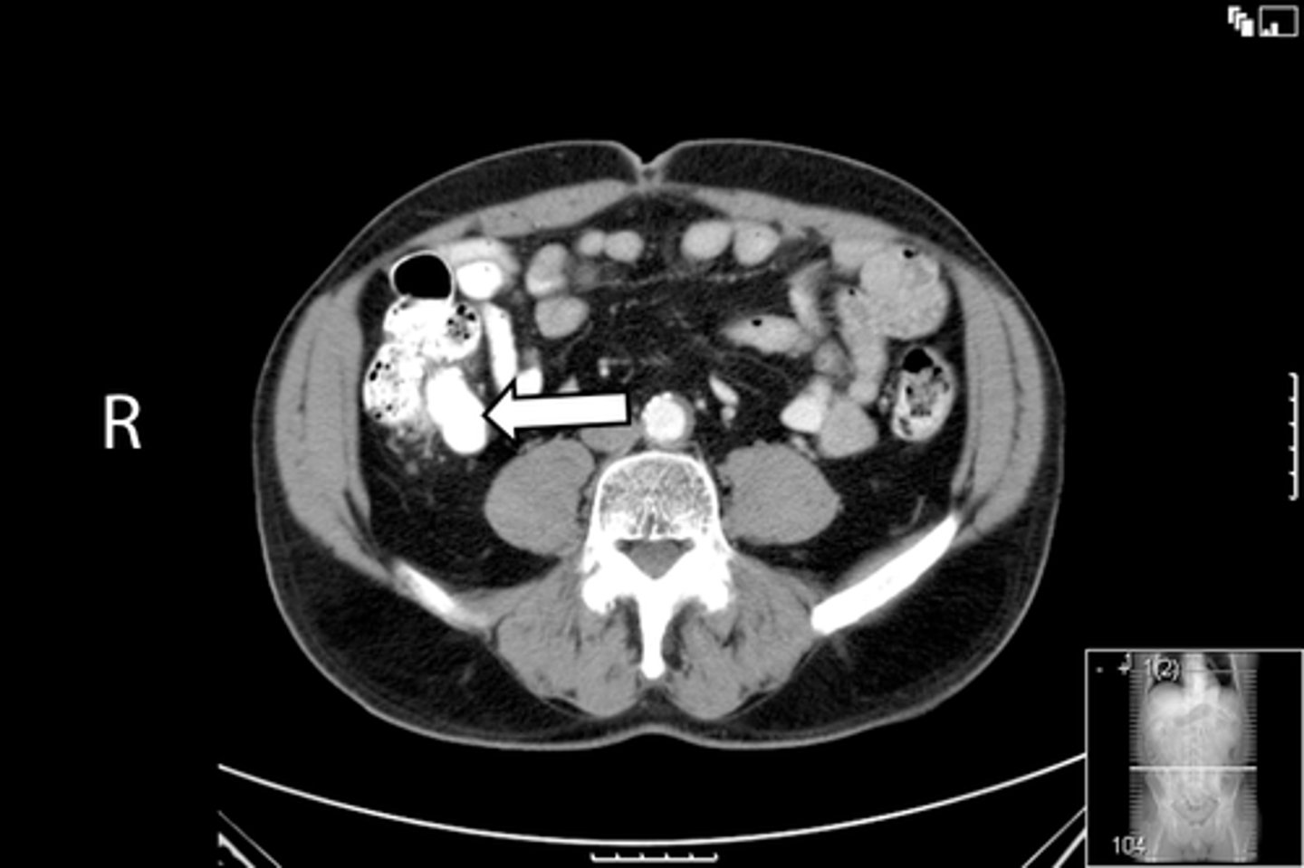 <p>What is indicated in the image?</p>