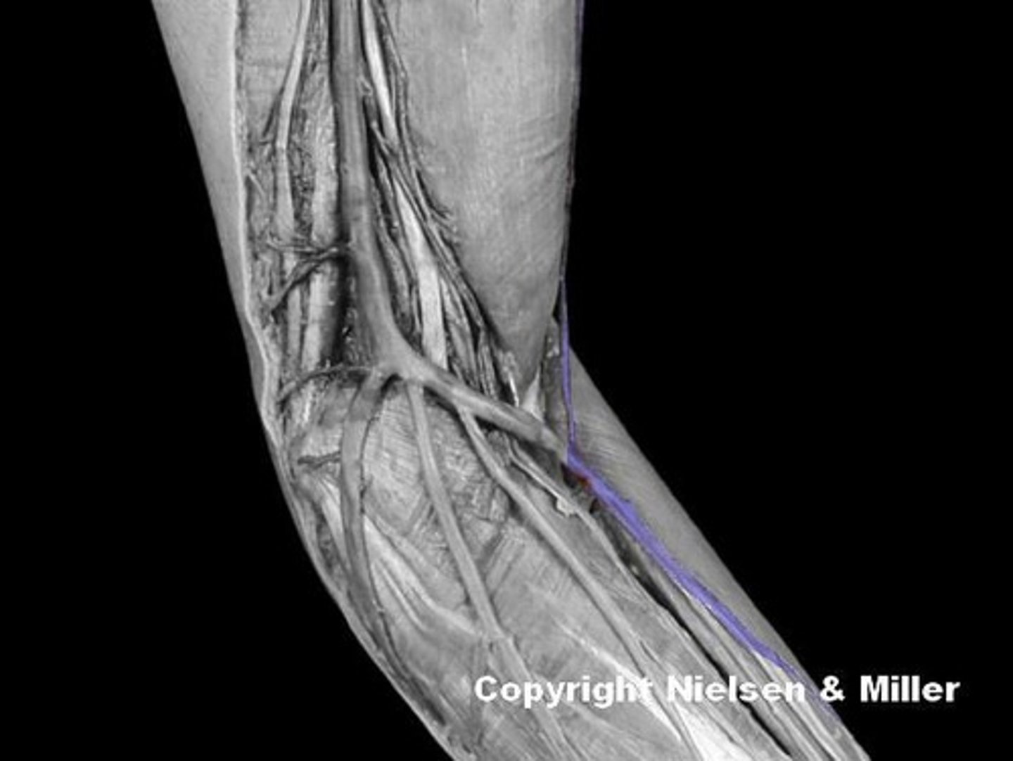 <p>Identify the highlighted vessel (anteromedial view of superficial veins of arm/forearm).</p>