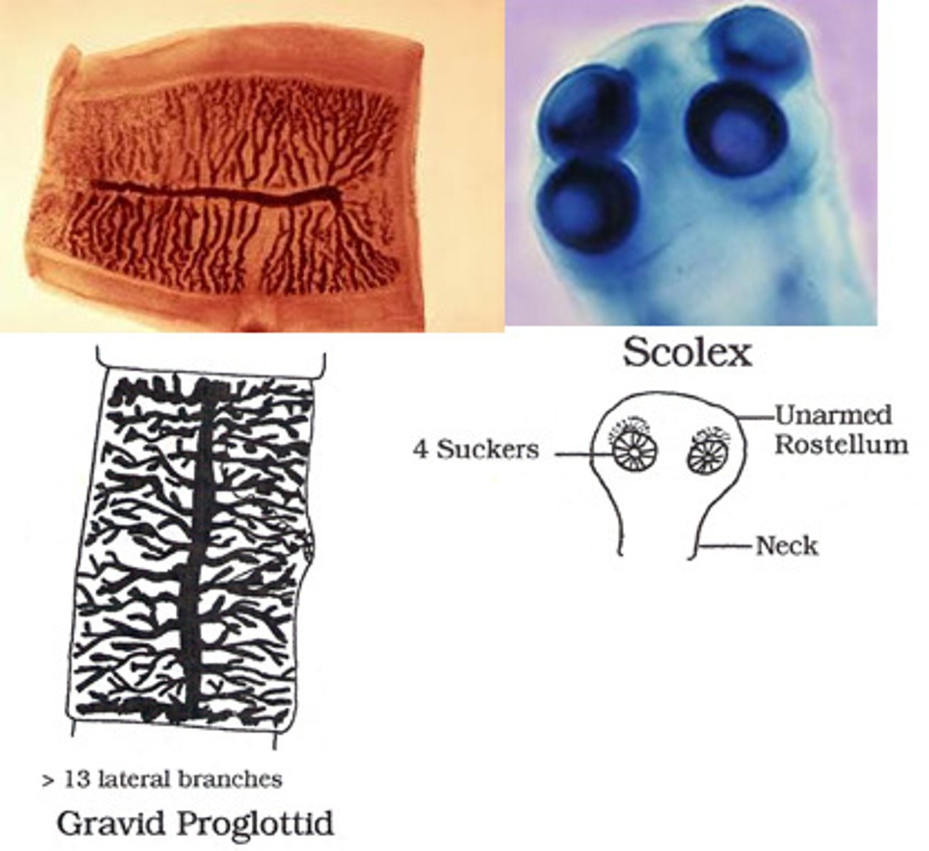 <p>• Eggs are identical to T.</p><p>solium</p><p>o Around 30-40 microns</p><p>• Worm</p><p>o Smooth scolex with</p><p>four suckers</p><p>o Proglottids</p><p>Longer than they are</p><p>wide</p><p>>13 uterine branches</p>