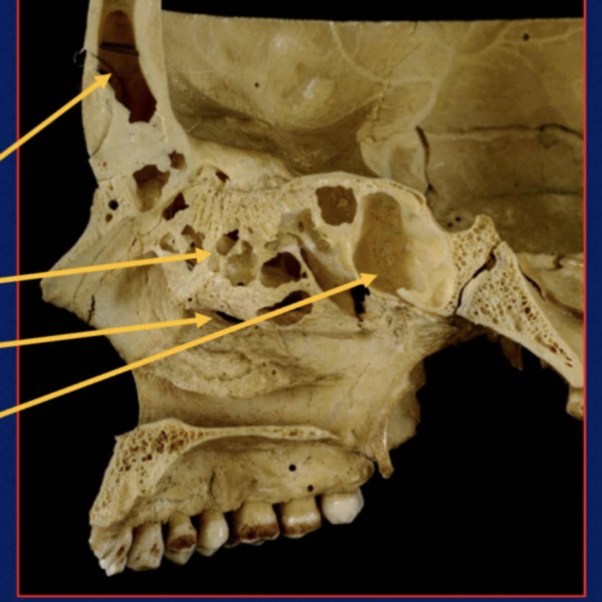 <p>2nd arrow</p>