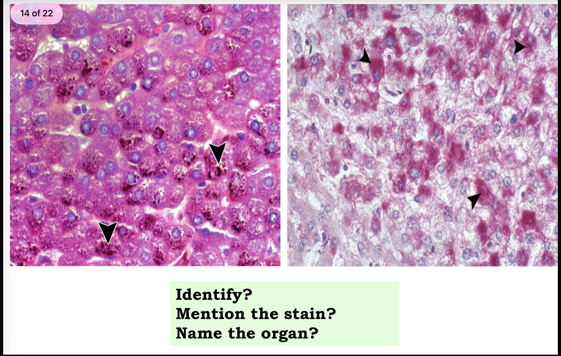 <p>Answer the questions in these following pictures</p>