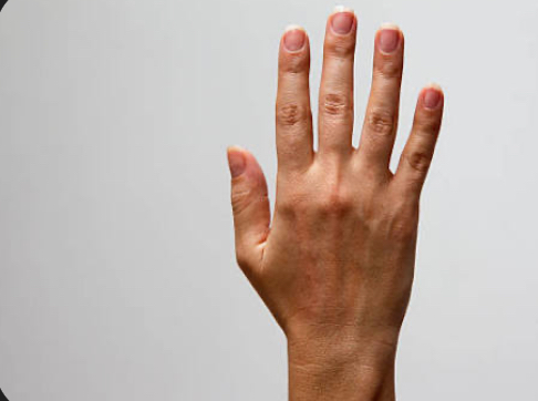 <p>hand extensor group</p>
