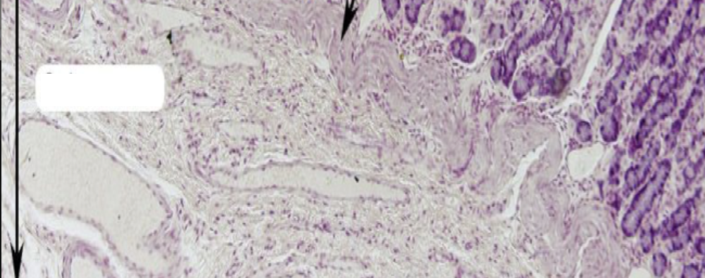 <p>T OR F:</p><p>The layer has:</p><ul><li><p>Meissner’s plexus</p></li><li><p>blood and lymphatic vessels</p></li><li><p>gastric glands</p></li></ul>