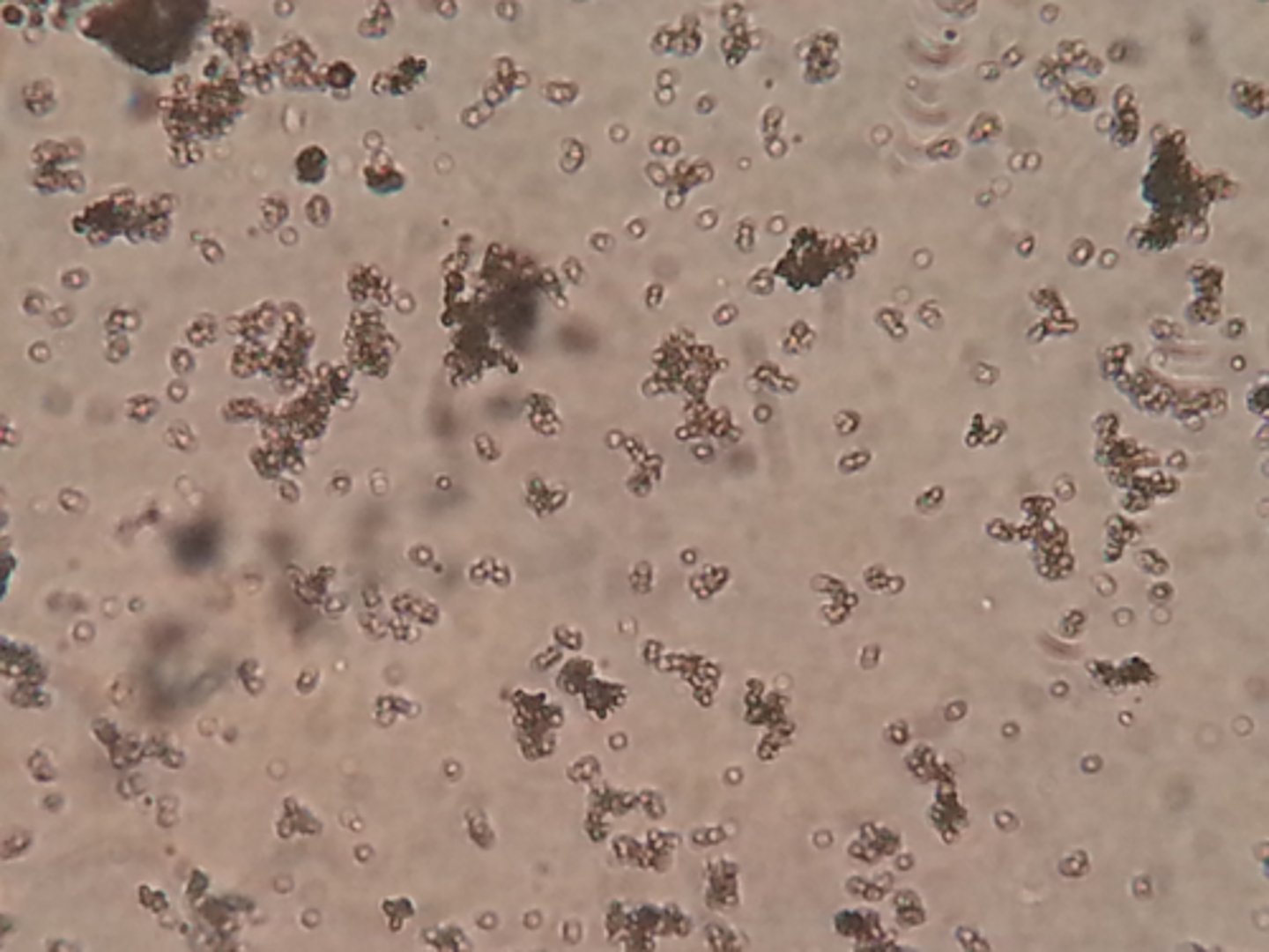 <p>- Almost identical to amorphous urates</p><p>- Granular appearance</p><p>- Different sizes and shapes clumped together</p><p>- Due to refrigeration or urine sitting out</p>