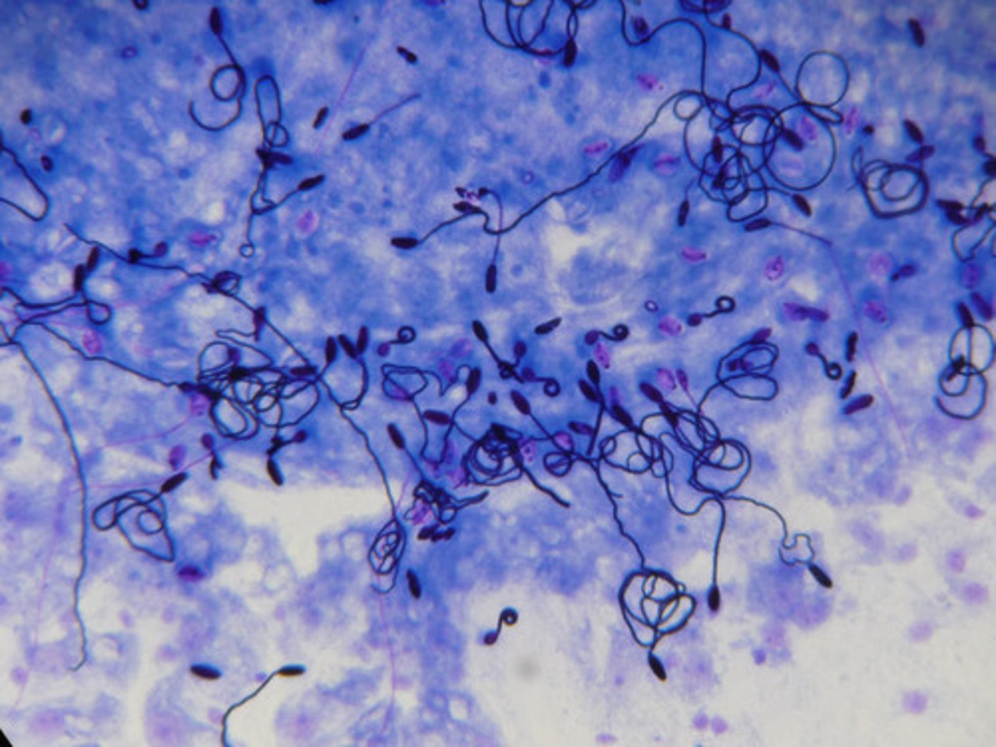 <p>Small capsules that contain a toxin which is injected into prey or predators</p>