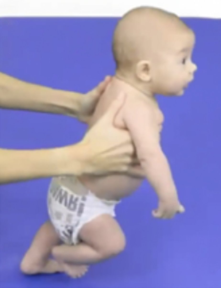 <p>Insufficient head and neck flexor control with head lag</p><p>Back is flexed with head lifting</p><p>Increased awareness due to labyrinthine and optical righting reactions from the stimulus of head lifting</p><p>Lower extremity EROT</p><p>More control in standing</p>