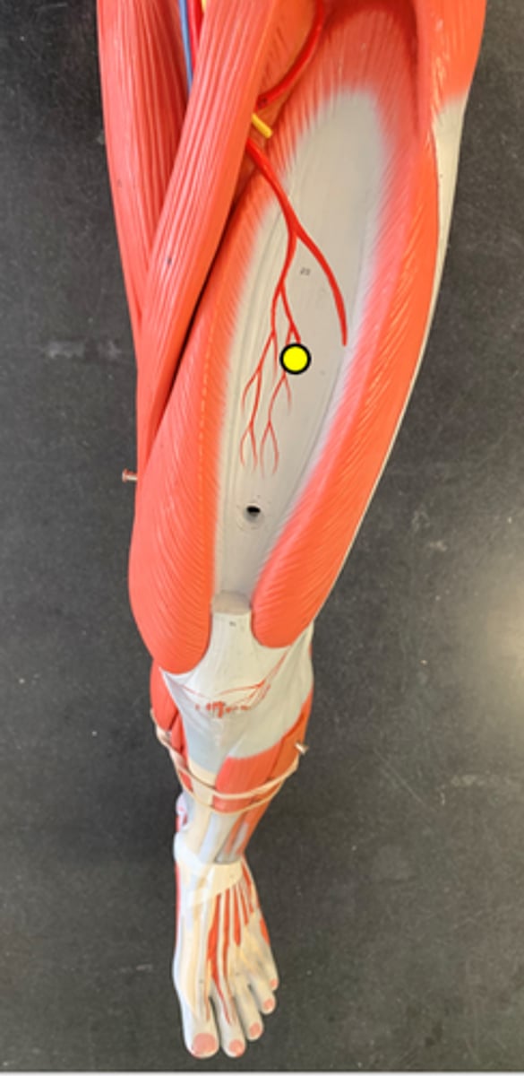 <p>Underneath rectus femoris</p>