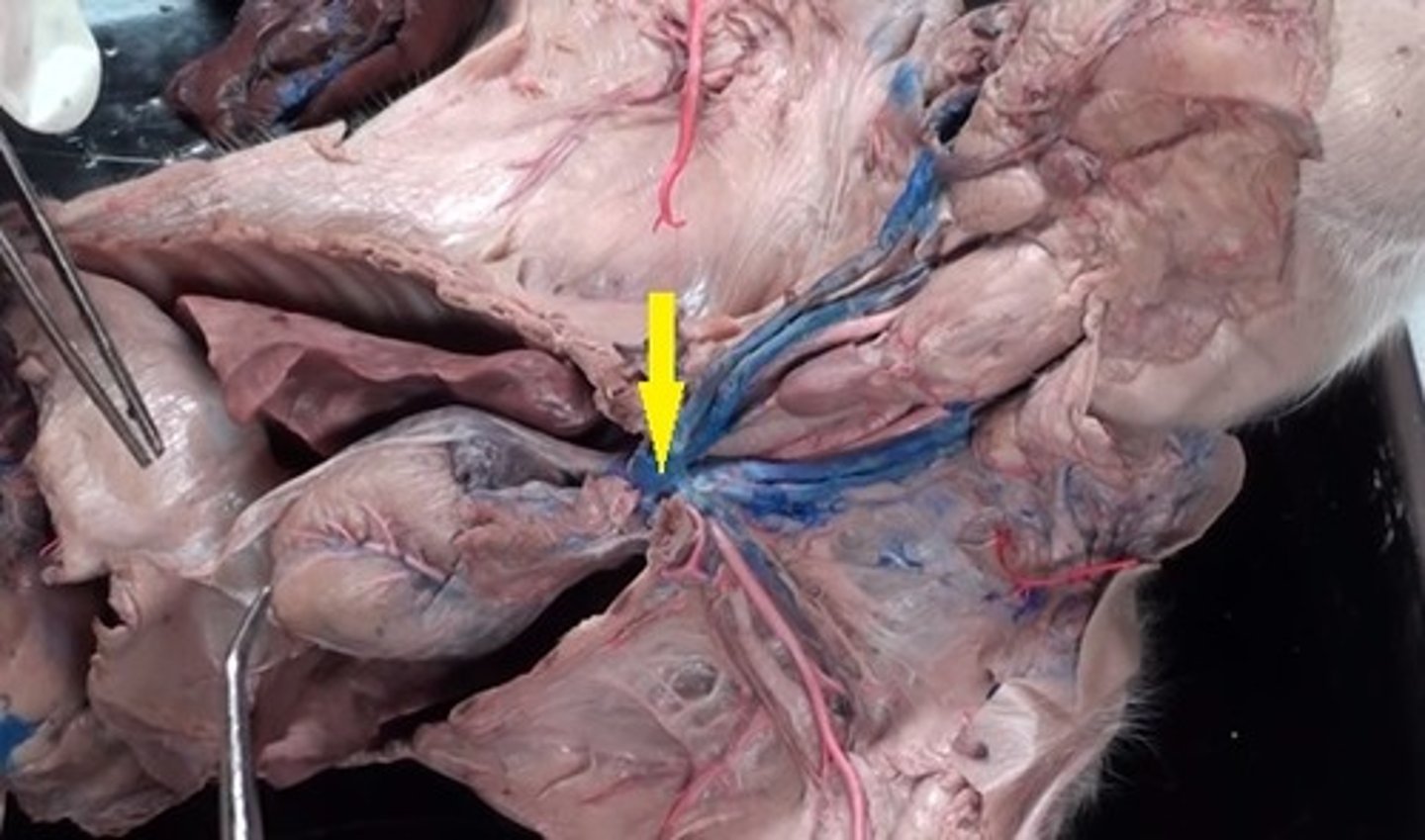 <p>Superior vena cava</p>
