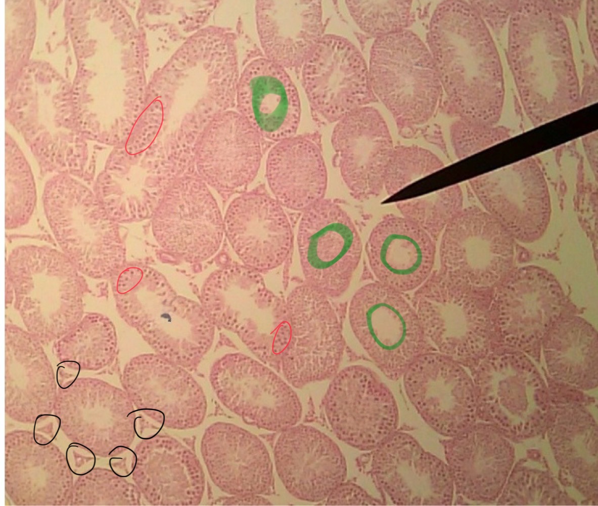 <p>inhibin</p>