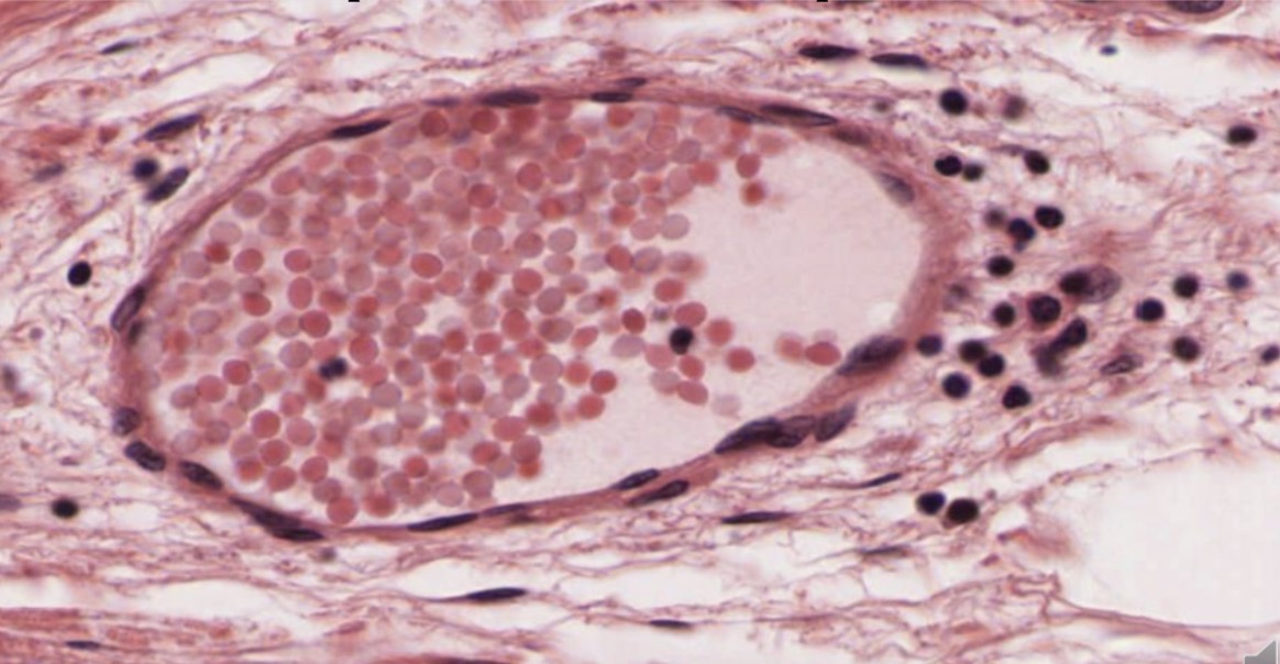 <p>Epitelio monoestratificado plano</p>