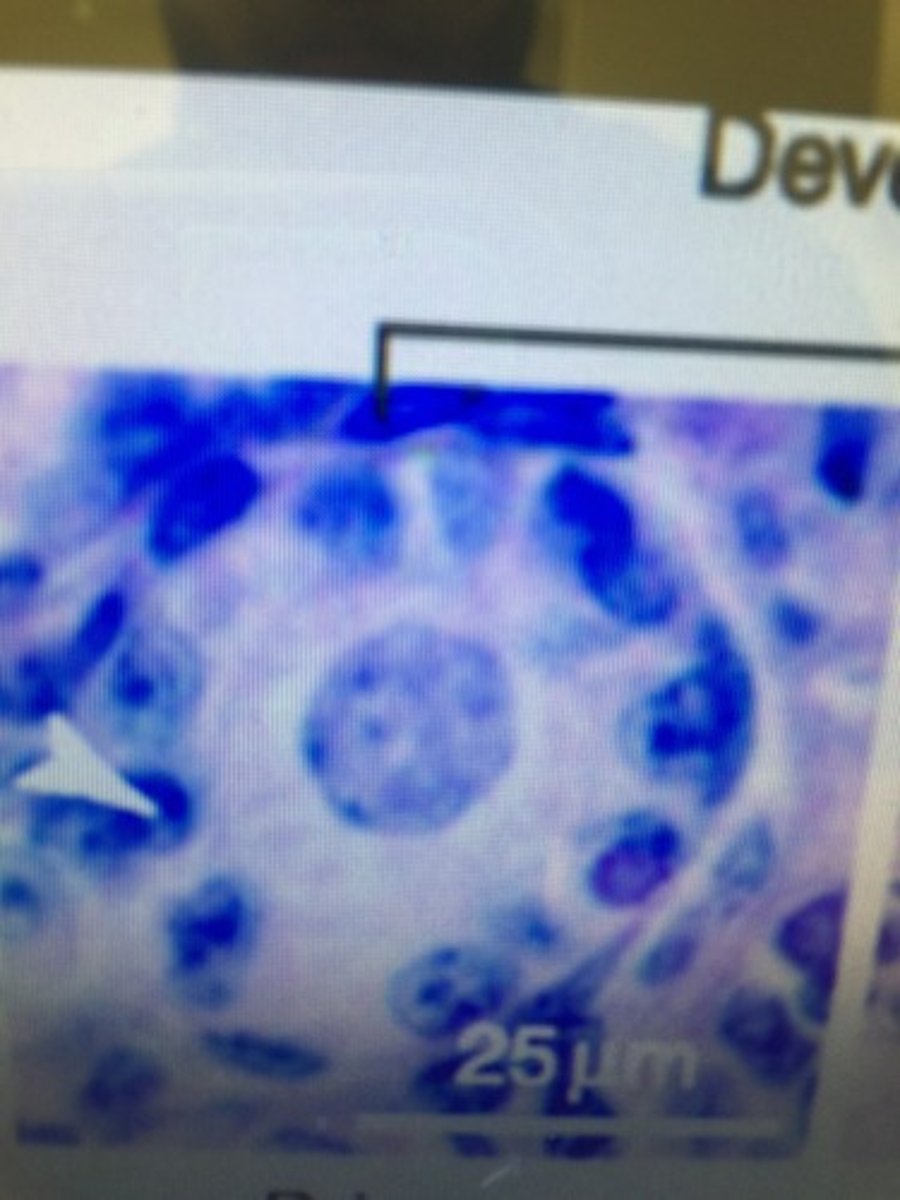 <p>The surviving germ cells following oogonia develop into these , which begin the first meiotic division before birth...?</p>