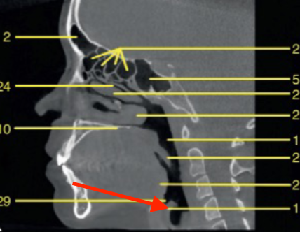 <p>identify the structure </p>