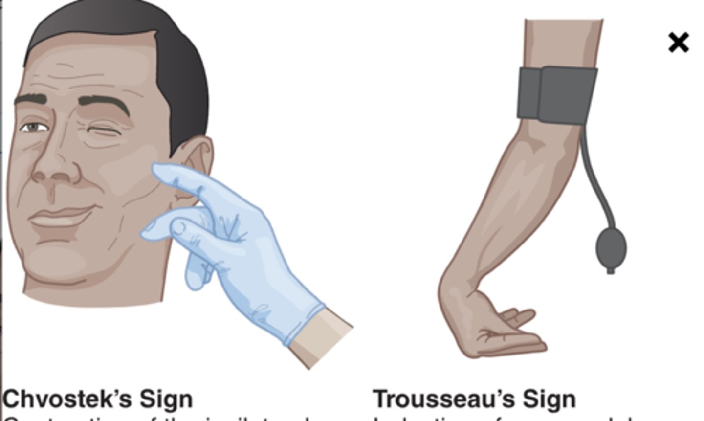<p>-numbness and tingling, muscle spasms, hyperactive deep tendon reflexes </p><p>-positive Chovostek and Trousseau sign</p><p>-causes by hypoparathyroidism after surgery or excess diarrhea or laxative misuse</p><p>-keep emergency tracheostomy equipment standby</p>