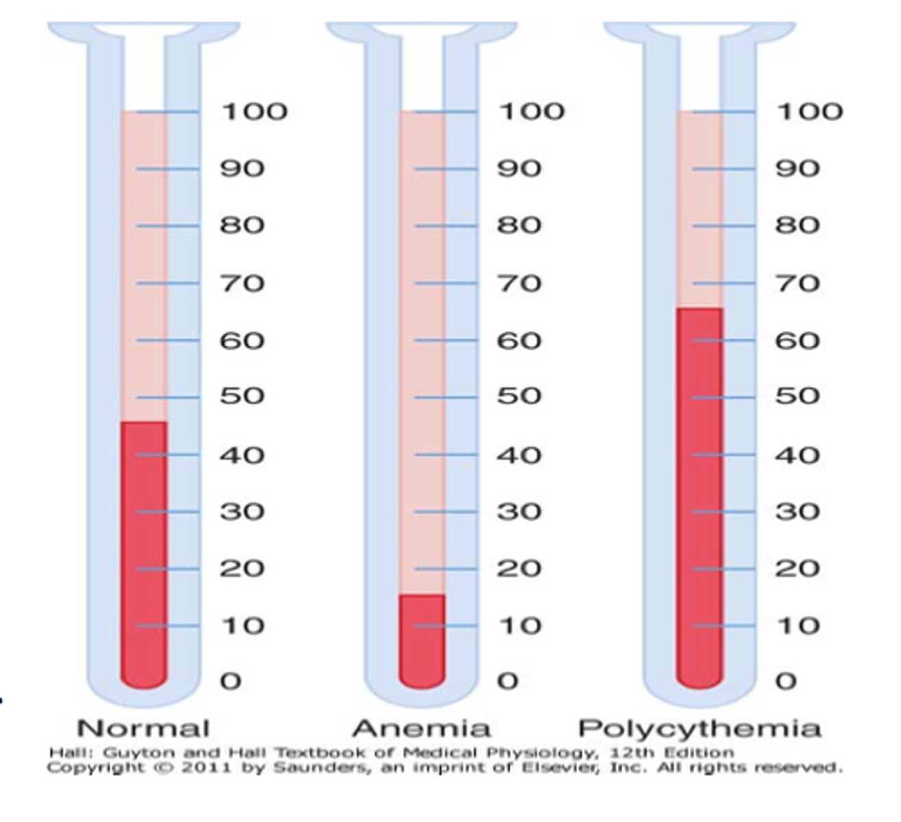 <p>males</p><p>hemoglobin: &lt; 13 gm/dL</p><p>hematocrit: &lt; 39%</p><p>females</p><p>hemoglobin: &lt; 12 gm/dL</p><p>hematocrit: &lt; 36%</p><p>** difference in male and female due to muscle mass</p>