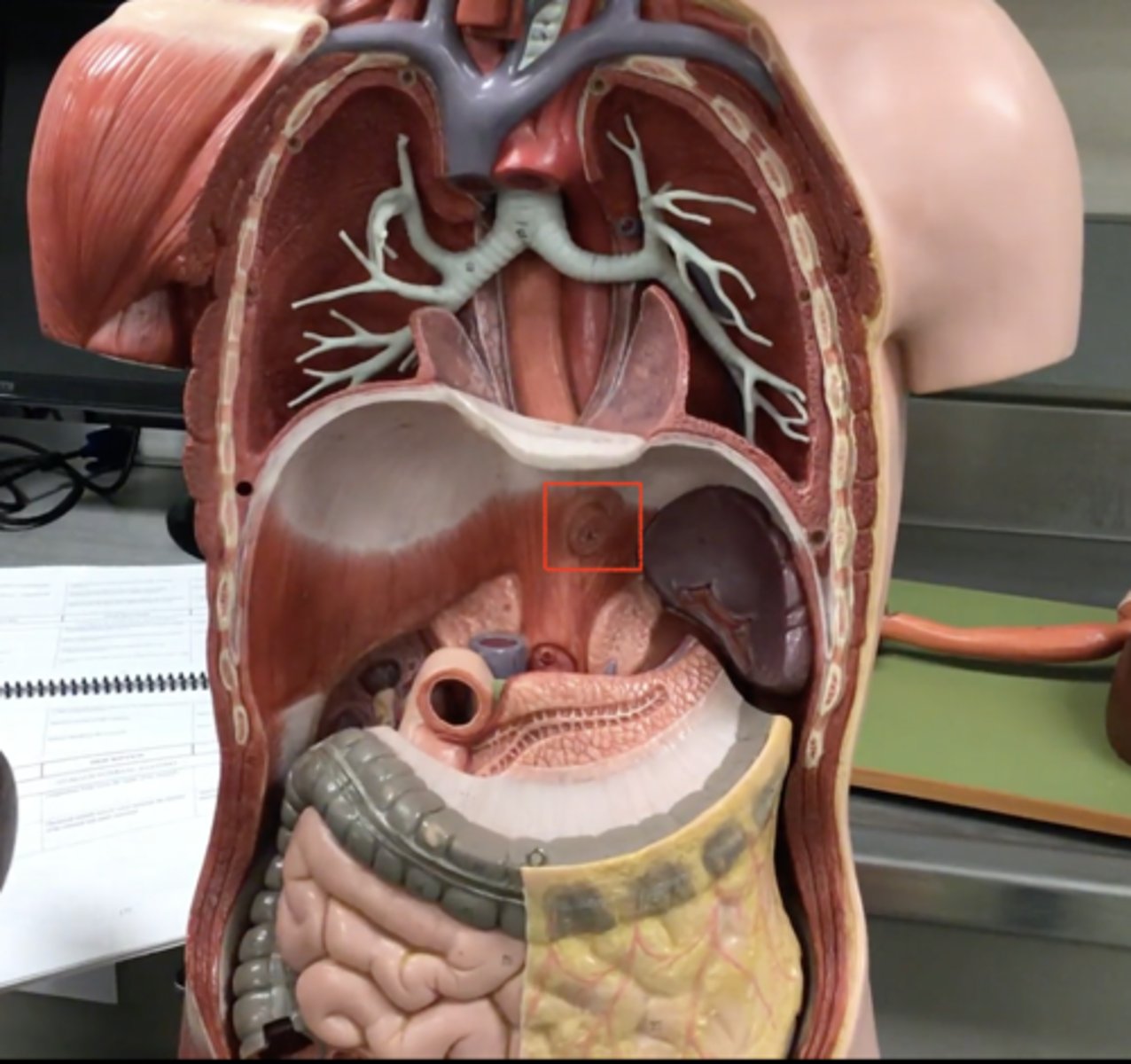 <p>Space in diaphragm that the esophagus passes</p>