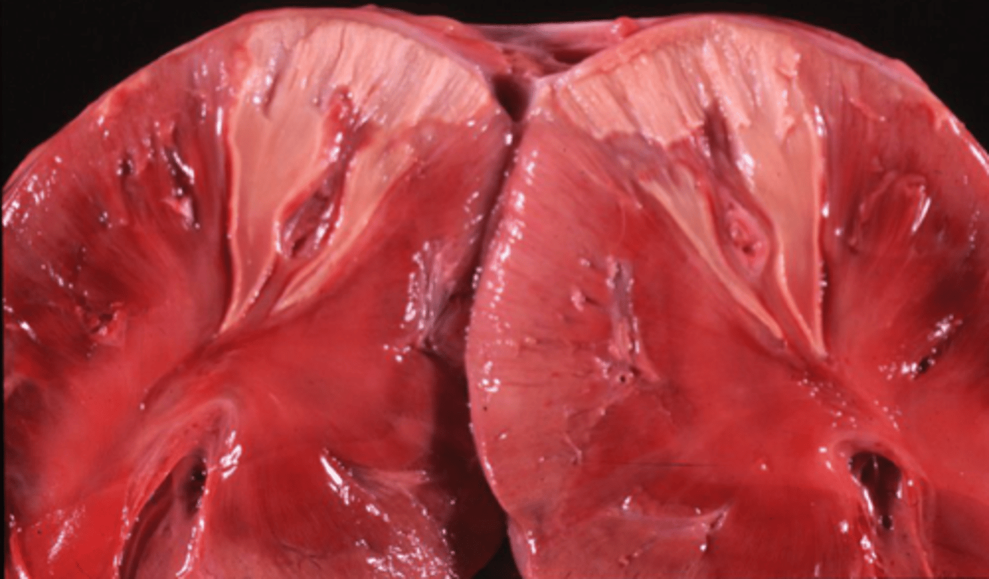 <p>what happened to these kidneys?</p>