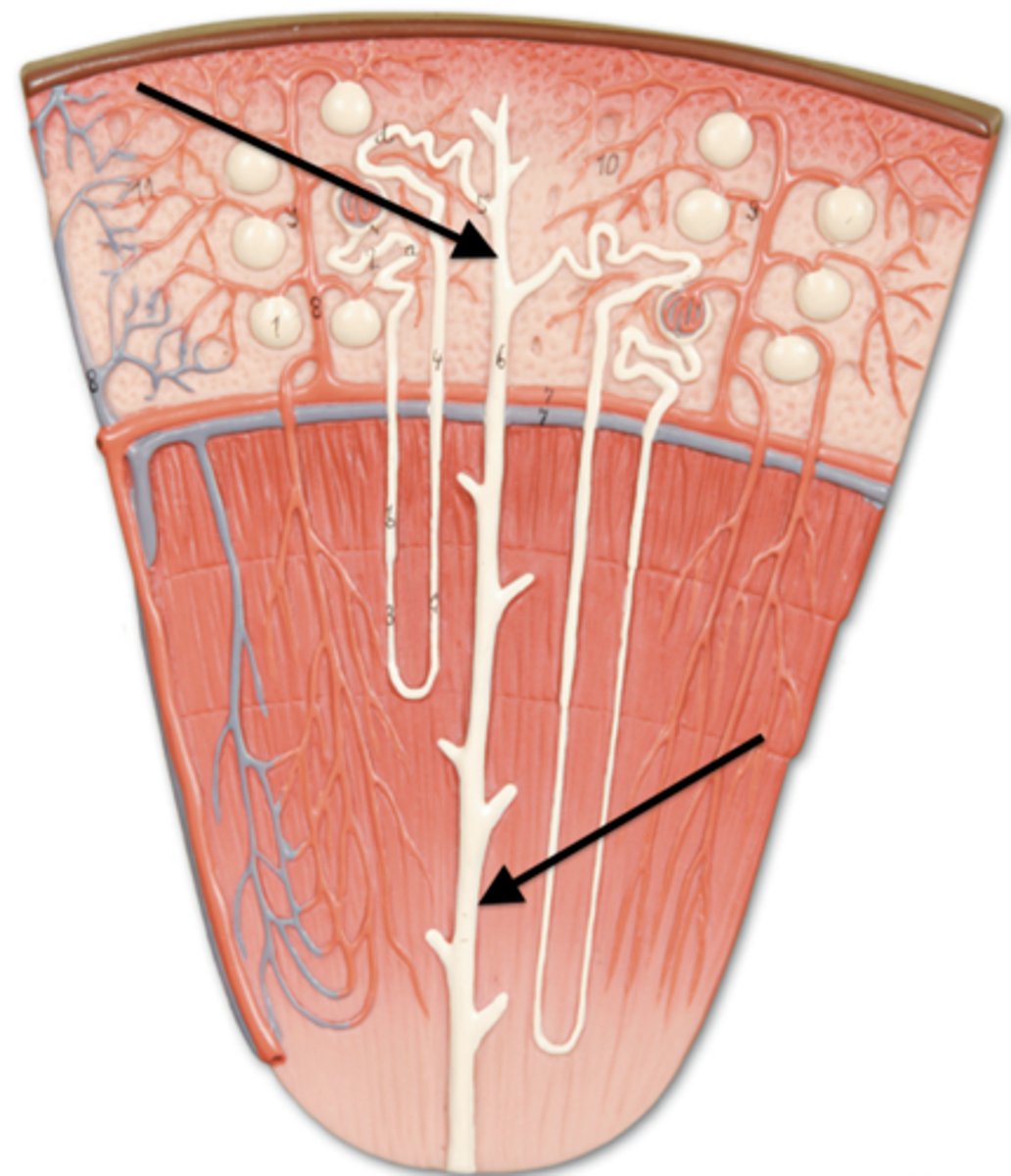 <p>medullary ray</p>
