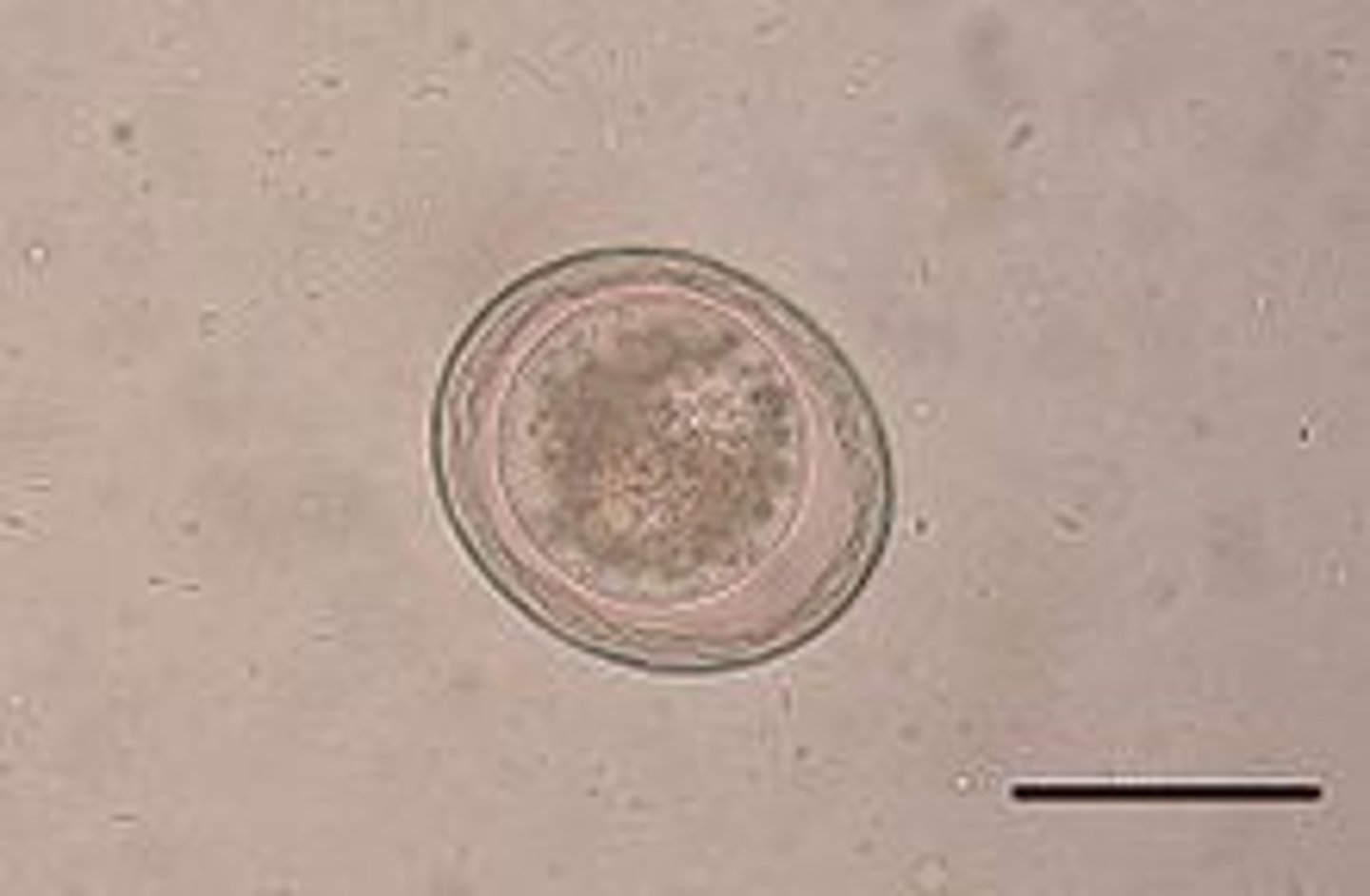 <p>What parasite is this if it is from a dog</p>