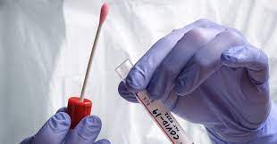 <p>PCR</p>